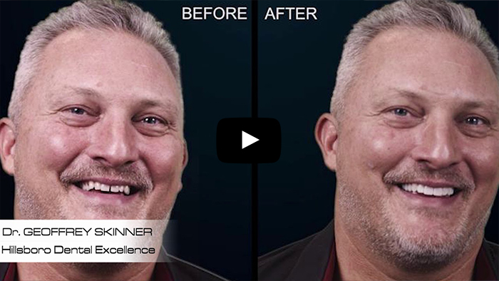 Before and After Digital Dentistry Thumbnail