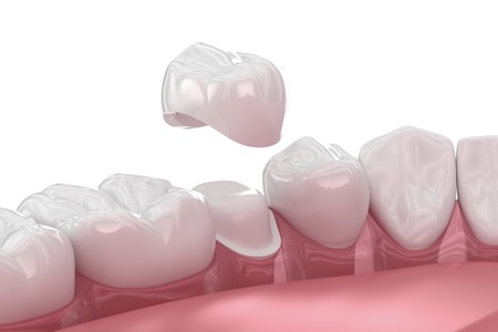 crown diagram