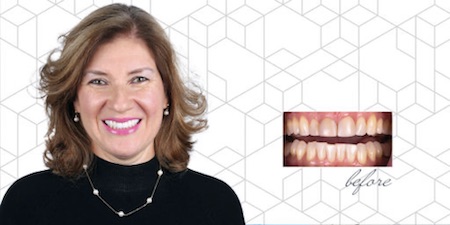 woman smiling