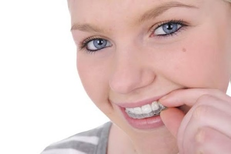 A girl with a beautiful smile showing her Invisalign.