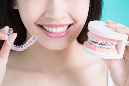 A beautiful girl with a lovely smile wearing her Invisalign braces.