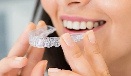 A beautiful woman with a beautiful smile wearing her Invisalign clear aligners.