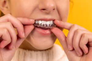 Person wearing clear dental aligners
