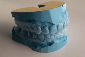 Dental plaster model of human teeth