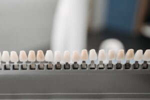 Dental shade guide for tooth color matching