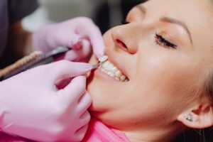 Dental veneers procedure patient smiling dentist