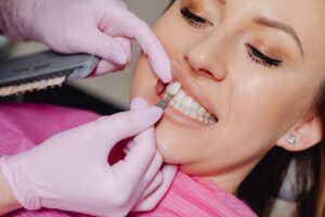 Dental veneer matching at dentist appointment