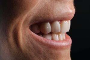 Close-up of a smiling mouth with teeth